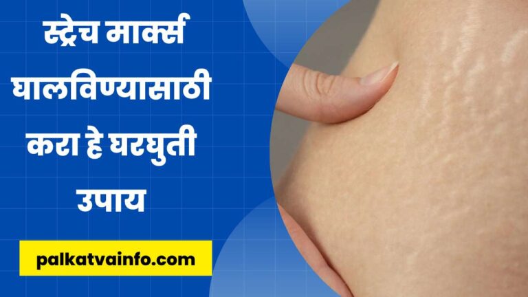 Home Remedies for Stretch Marks in Marathi